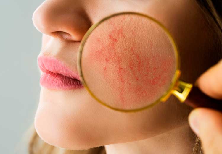Dermatologia-Clínica