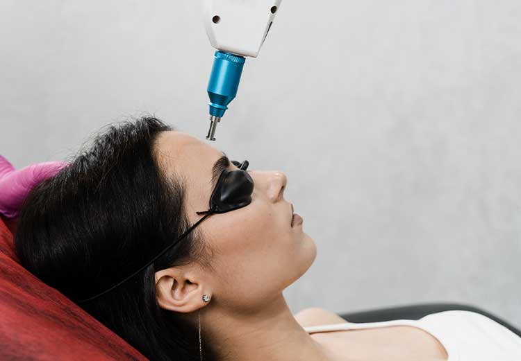 Laser-Thulium-ou-Erbium-com-Drug-Delivery